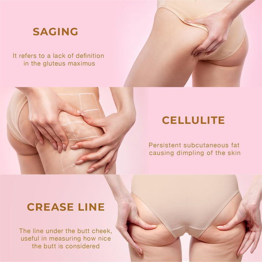 Skin Tightening Cream for Body: Cellulite Cream for Toning and Lifting Thighs, Butt, and Legs – Reduces Sagging Skin and Enhances Curves for a Youthful Look
